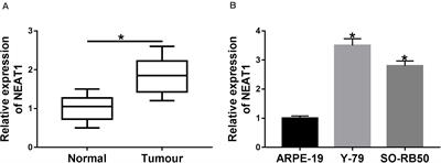 LncRNA NEAT1 Knockdown Inhibits Retinoblastoma Progression by miR-3619-5p/LASP1 Axis